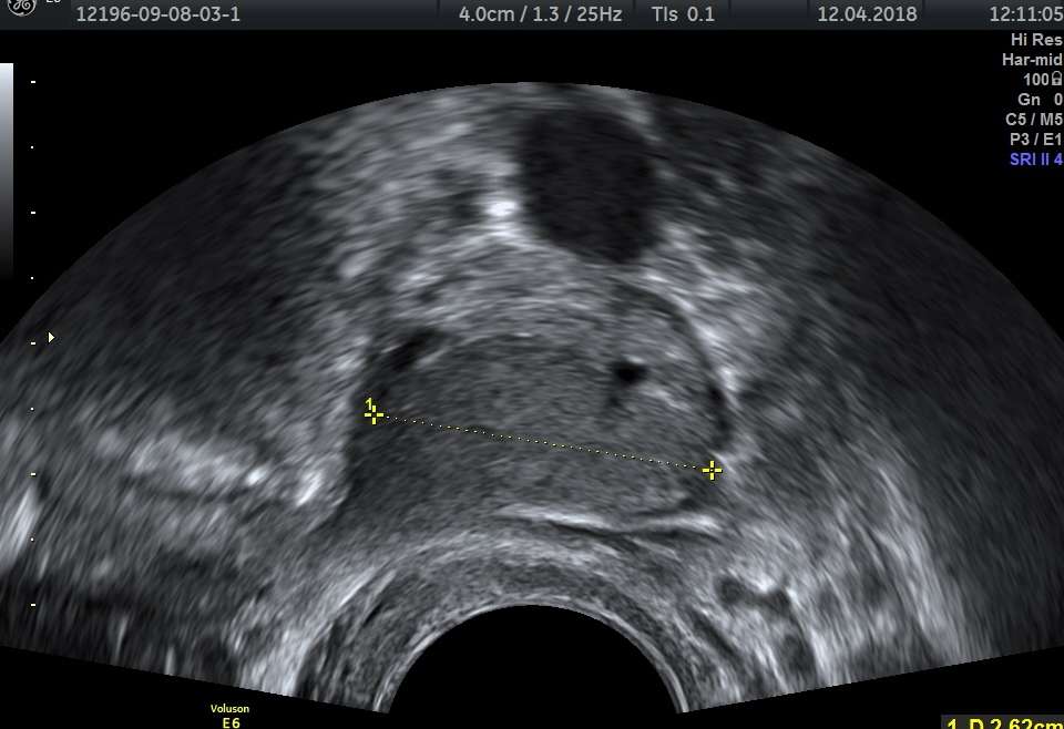 Ultrazvučni pregled